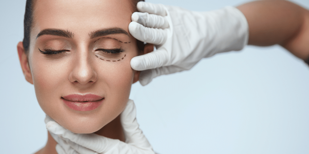 How Long Does It Take To Recover From Blepharoplasty?