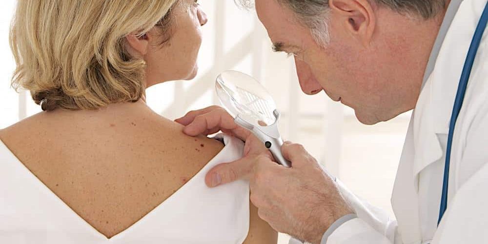 Skin Check - Cysts