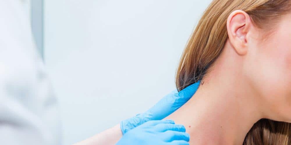 Mole Skin Check