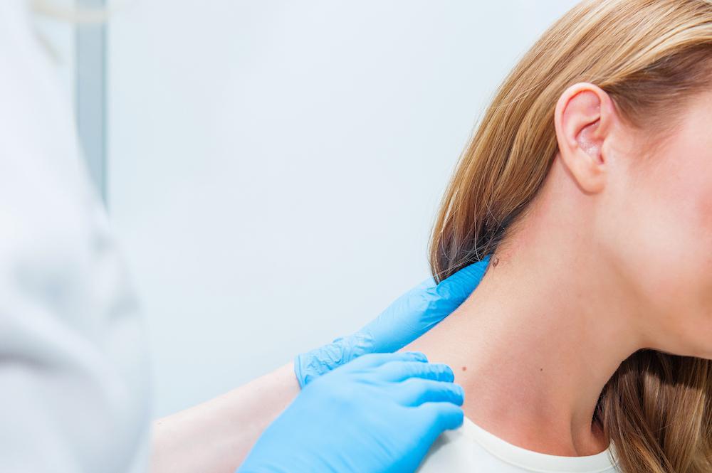 Mole skin check