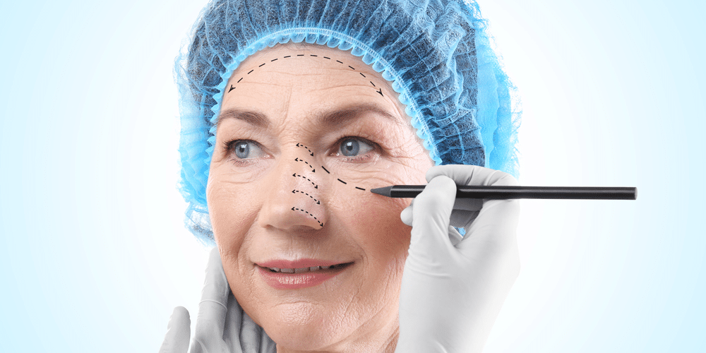 What Is Recovery Like After Blepharoplasty?