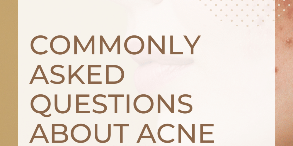 Commonly Asked Acne-questions
