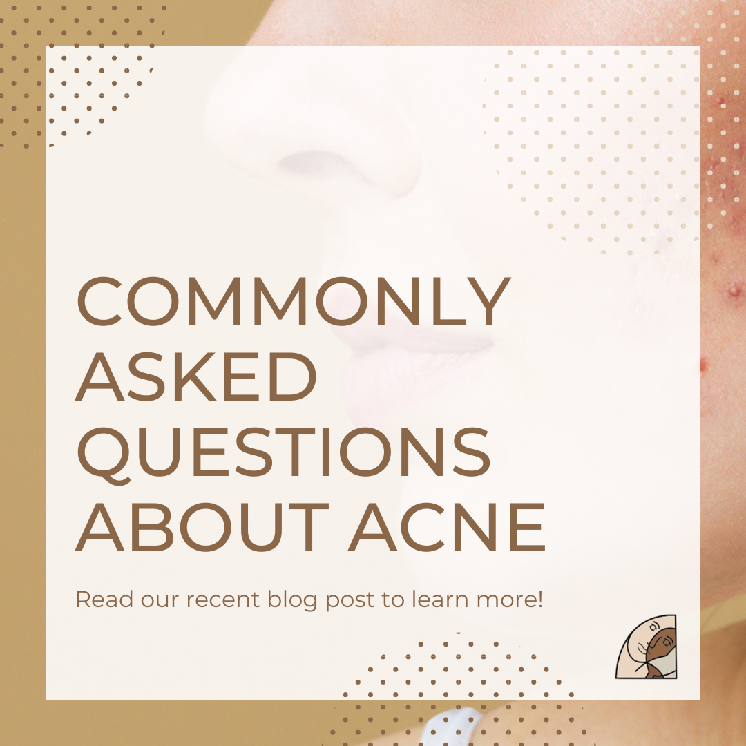 commonly asked acne-questions
