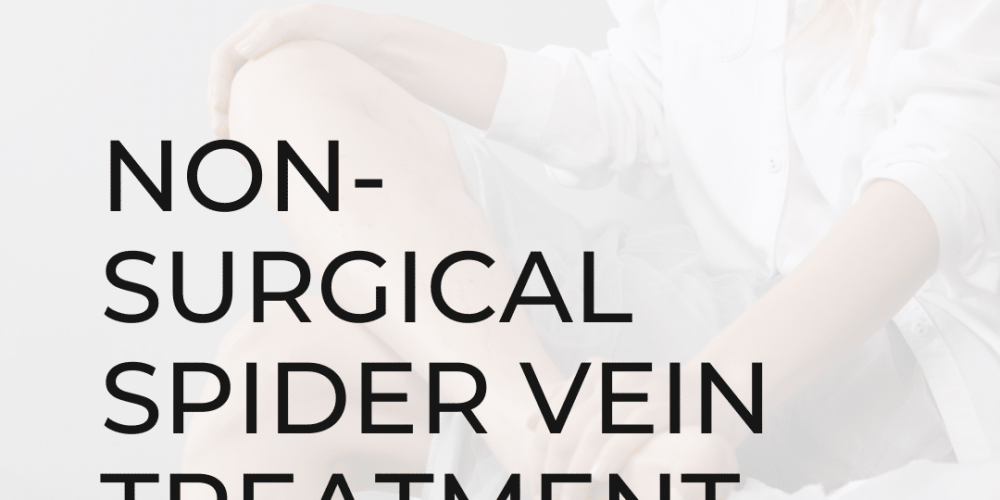 Non-Surgical Spider Vein Treatment
