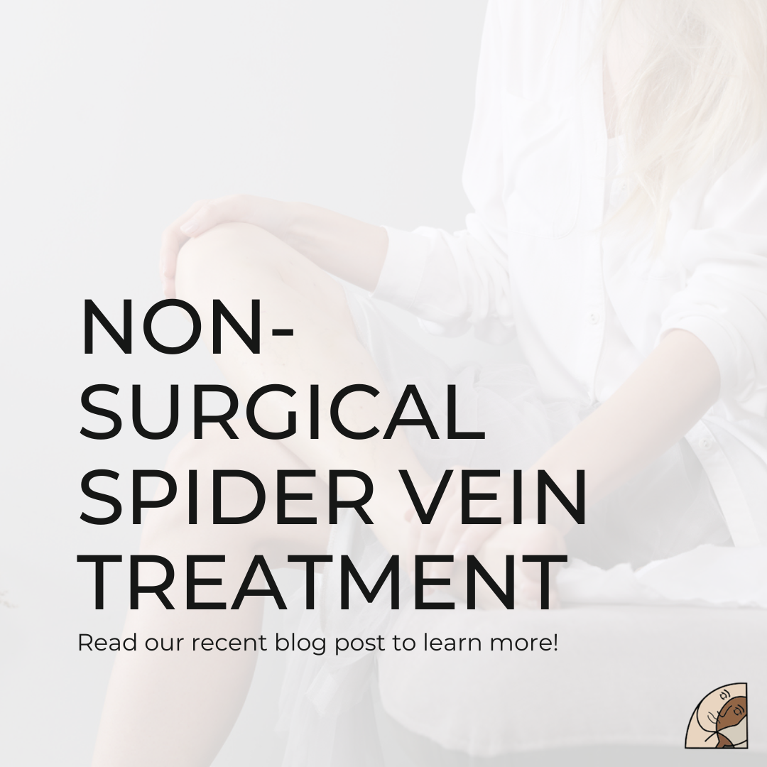Non-Surgical Spider Vein Treatment