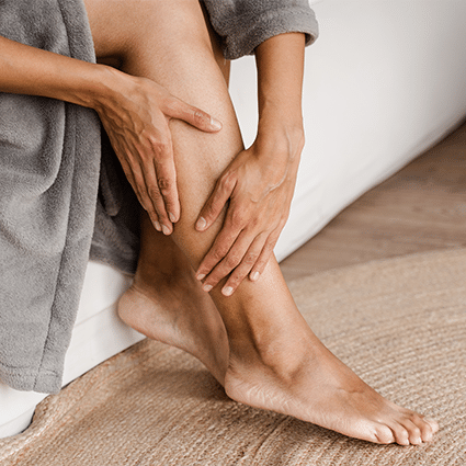 Everything You Need To Know About Spider Veins
