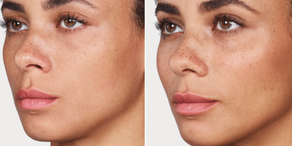 Before And After Image