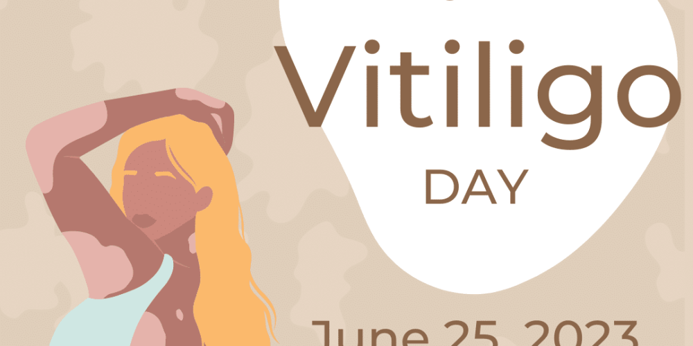 Raising Awareness And Providing Support: SkinMD Celebrates World Vitiligo Day