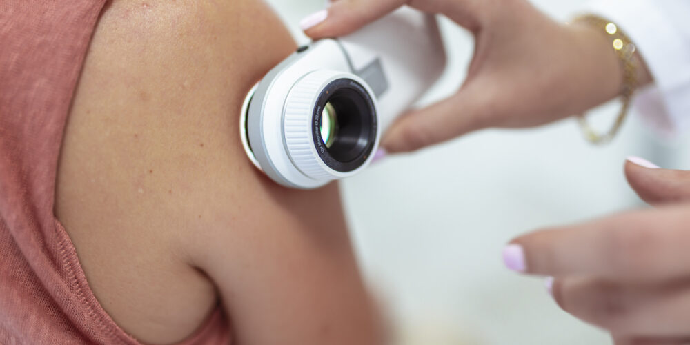 A Dermatologist Performs A Skin Examination To Detect And Assess Skin Cancer Carcinomas.