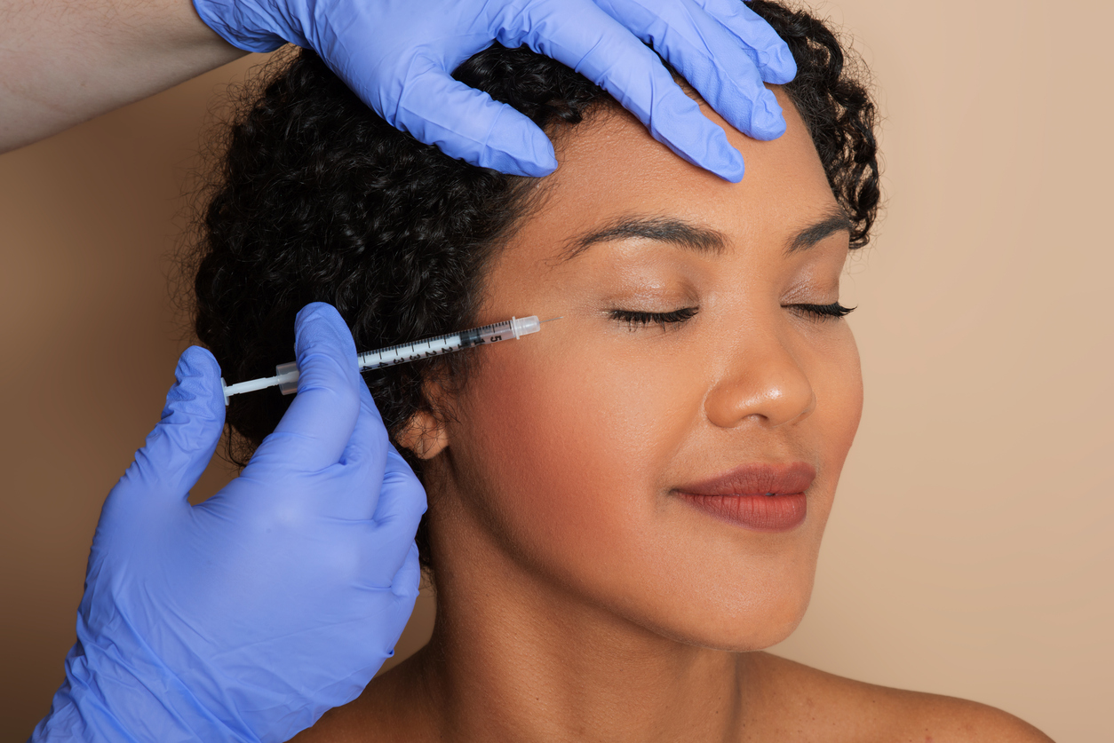A woman with dark hair smiles as she receives dermal filler to smooth out the appearance of fine lines and wrinkles around her eyes.
