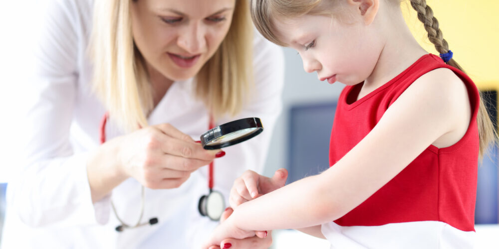A Pediatric Dermatologist Examines A Child's Arm With A Magnifying Glass During A Skin Evaluation For Atopic Dermatitis.