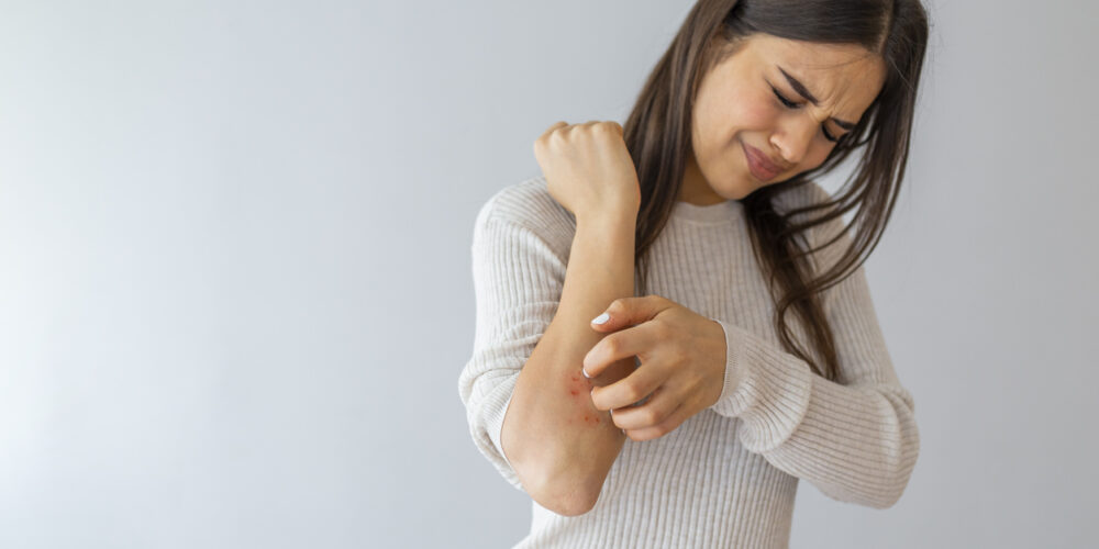 A Woman With Long, Brunette Hair Winces In Pain And Scratches Her Dry, Red Forearm, Experiencing A Winter Eczema Flare-up.