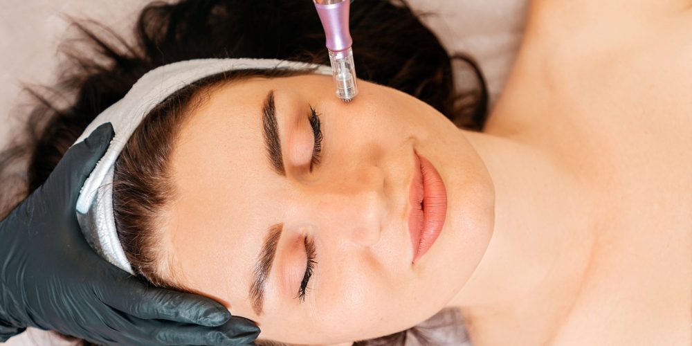 A Woman With Dark Brown Hair Closes Her Eyes As She Receives A SkinPen® Microneedling Facial Treatment.