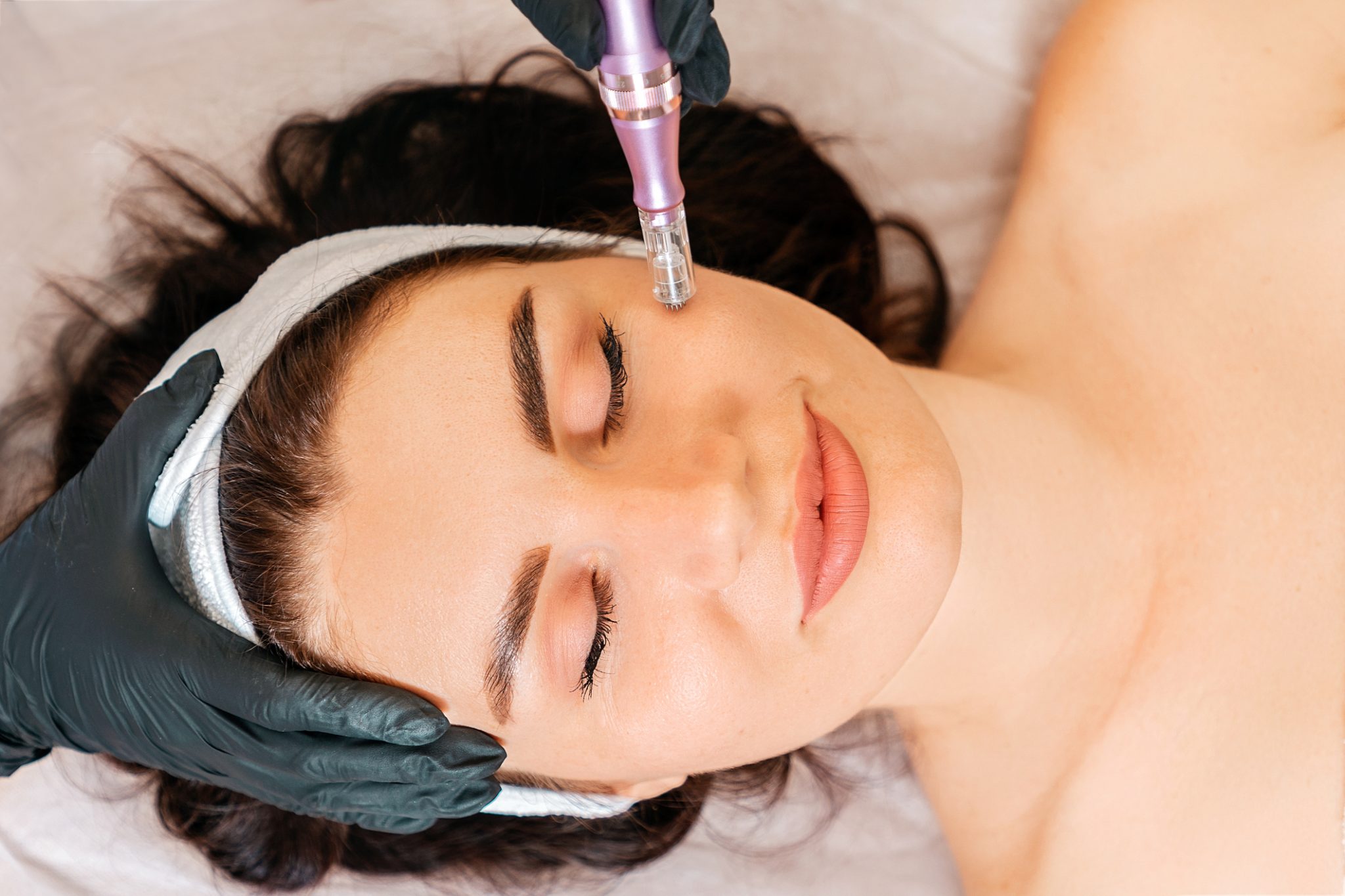A woman with dark brown hair closes her eyes as she receives a SkinPen® microneedling facial treatment.